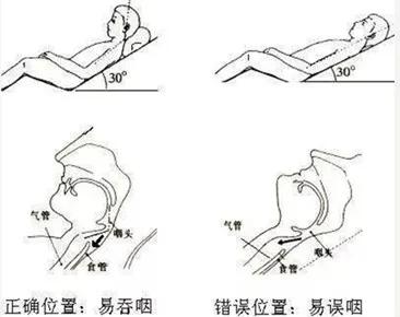 外科手术后吃什么好？