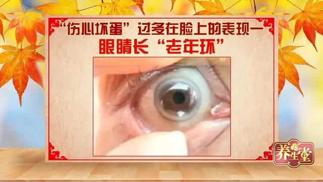 吃什么可以通血管，喝什么血管通畅不堵还降血脂