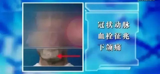 吃什么可以通血管，喝什么血管通畅不堵还降血脂