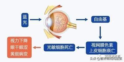 吃什么可以治疗近视，青少年近视眼补充什么营养