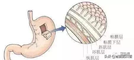 糜烂出血性胃炎吃什么好，糜烂性胃炎怎么治疗才能彻底治愈